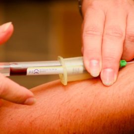 Biopuncture and Other Invasive Options for Injuries
