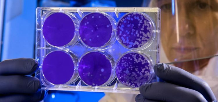 HeLa Cells Contamination of Cell Cultures Shocks Scientists