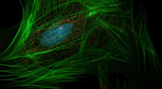 Immortal Cells: Scientific and Spiritual Reasons for HeLa Immortal Cells: Scientific and Spiritual Reasons for HeLa