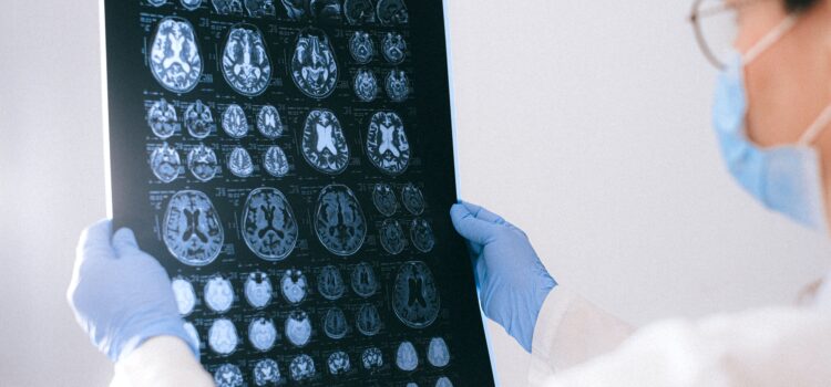 How PTSD Brain Imaging Reveals the Truth of Trauma