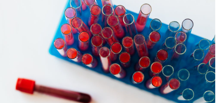 Blood Cancer: Causes, Types, and Prevention Blood Cancer: Causes, Types, and Prevention