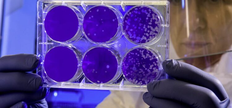 The Body’s Defense Against Pathogens and Bacteria The Body’s Defense Against Pathogens and Bacteria