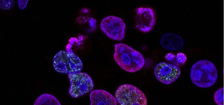 How Do Genes Impact Health and Disease? How Do Genes Impact Health and Disease?