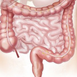 What Happens in the Small Intestine?