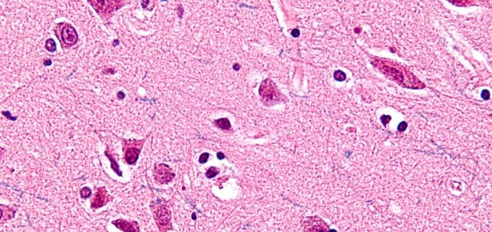 A very high magnification micrograph of the spindle neurons (also known as Von Economo neurons) of the cingulate